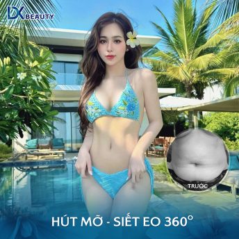 HÚT MỠ